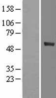 CYP4F12 Human Over-expression Lysates NM_023944