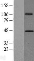 CHID1 Human Over-expression Lysates NM_001142675