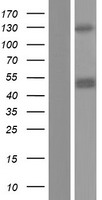 CHID1 Human Over-expression Lysates NM_001142676