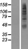 ls066035 slc2a11 human over expression lysates nm 001024938 wb testing 1