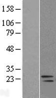 ls078986 dusp26 human over expression lysates nm 024025 wb testing 1