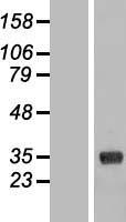 COLEC11 Human Over-expression Lysates NM_199235