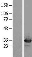 OTUB2 Human Over-expression Lysates NM_023112