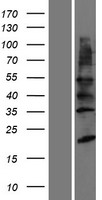 YIPF2 Human Over-expression Lysates NM_024029