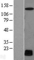 MRI (C7orf49) Human Over-expression Lysates NM_024033
