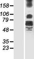 LRFN4 Human Over-expression Lysates NM_024036