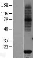 VKORC1 Human Over-expression Lysates NM_024006