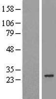 MIS12 Human Over-expression Lysates NM_024039
