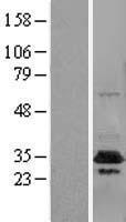 CUEDC2 Human Over-expression Lysates NM_024040