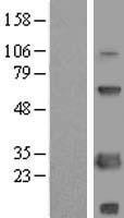 ls079005 scnm1 human over expression lysates nm 024041 wb testing 1