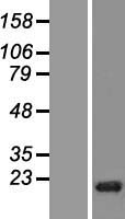 GIYD2 (SLX1B) Human Over-expression Lysates NM_178044