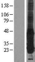 GGCT Human Over-expression Lysates NM_024051