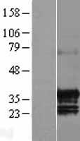 C17ORF39 (GID4) Human Over-expression Lysates NM_024052