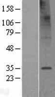 TMEM106C Human Over-expression Lysates NM_024056
