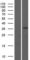 ERI3 Human Over-expression Lysates NM_024066