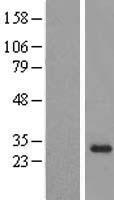 OBFC2B (NABP2) Human Over-expression Lysates NM_024068