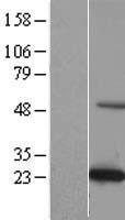 C19orf50 (KXD1) Human Over-expression Lysates NM_024069