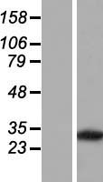 PVRIG Human Over-expression Lysates NM_024070