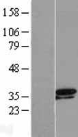 TSEN34 Human Over-expression Lysates NM_024075