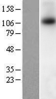 TRPM8 Human Over-expression Lysates NM_024080