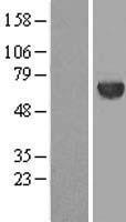 METT10D (METTL16) Human Over-expression Lysates NM_024086