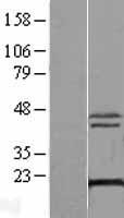 ls079077 xtp3tpa dctpp1 human over expression lysates nm 024096 wb testing 1