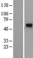 ls079080 ccdc86 human over expression lysates nm 024098 wb testing 1