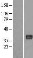 ls079081 c11orf48 lbhd1 human over expression lysates nm 024099 wb testing 1