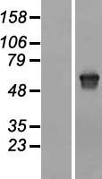 Melanophilin (MLPH) Human Over-expression Lysates NM_001042467