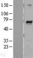 Melanophilin (MLPH) Human Over-expression Lysates NM_024101