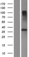 TMUB2 Human Over-expression Lysates NM_001076674