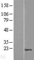 TMUB2 Human Over-expression Lysates NM_177441