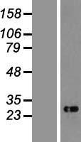 CHAC1 Human Over-expression Lysates NM_024111
