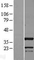 C11orf49 Human Over-expression Lysates NM_001003677