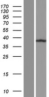 C11orf49 Human Over-expression Lysates NM_001003678