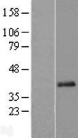 ls079096 c11orf49 human over expression lysates nm 024113 wb testing 3