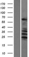 SARG (C1orf116) Human Over-expression Lysates NM_023938