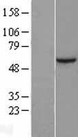 ls079109 sin1 mapkap1 human over expression lysates nm 001006618 wb testing 4