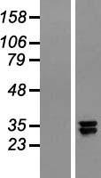 C20orf7 (NDUFAF5) Human Over-expression Lysates NM_001039375