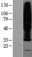 TMEM185B (NR_000034) Human Over-expression Lysates TMEM185B NR_000034