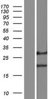 DERL1 Human Over-expression Lysates NM_001134671