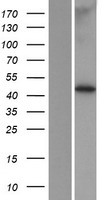 LENG4 (MBOAT7) Human Over-expression Lysates NM_024298