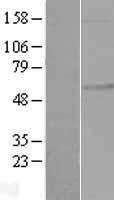 FKRP Human Over-expression Lysates NM_024301