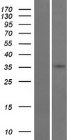 GDPD3 Human Over-expression Lysates NM_024307