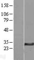 DHRS11 Human Over-expression Lysates NM_024308