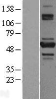 ls079155 tnip2 human over expression lysates nm 024309 wb testing 1