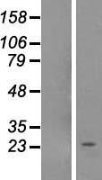 NOL12 Human Over-expression Lysates NM_024313