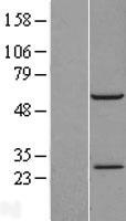 RBM42 Human Over-expression Lysates NM_024321