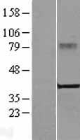 CRELD2 Human Over-expression Lysates NM_024324