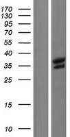 BRCC36 (BRCC3) Human Over-expression Lysates NM_001018055
